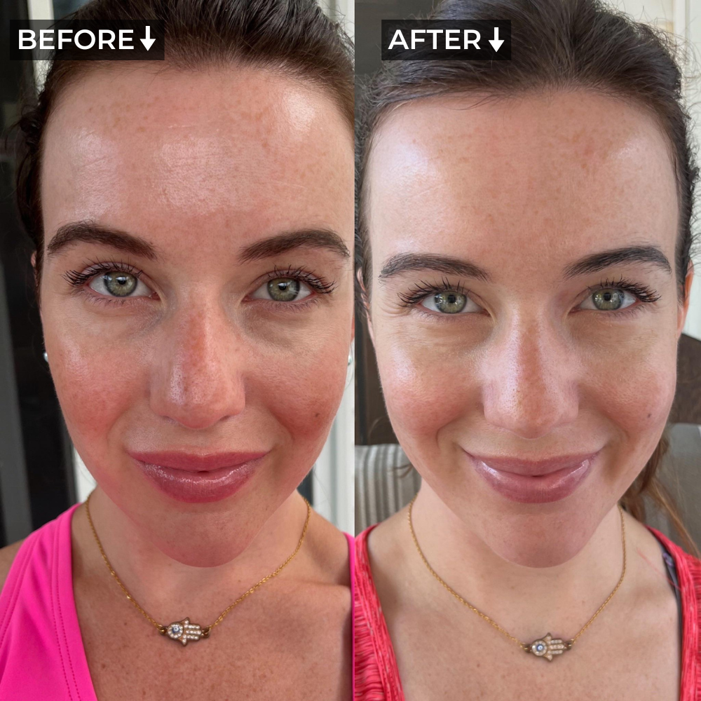 AURA+ Nuvibody® LED-Maske + Dekolleté-Set