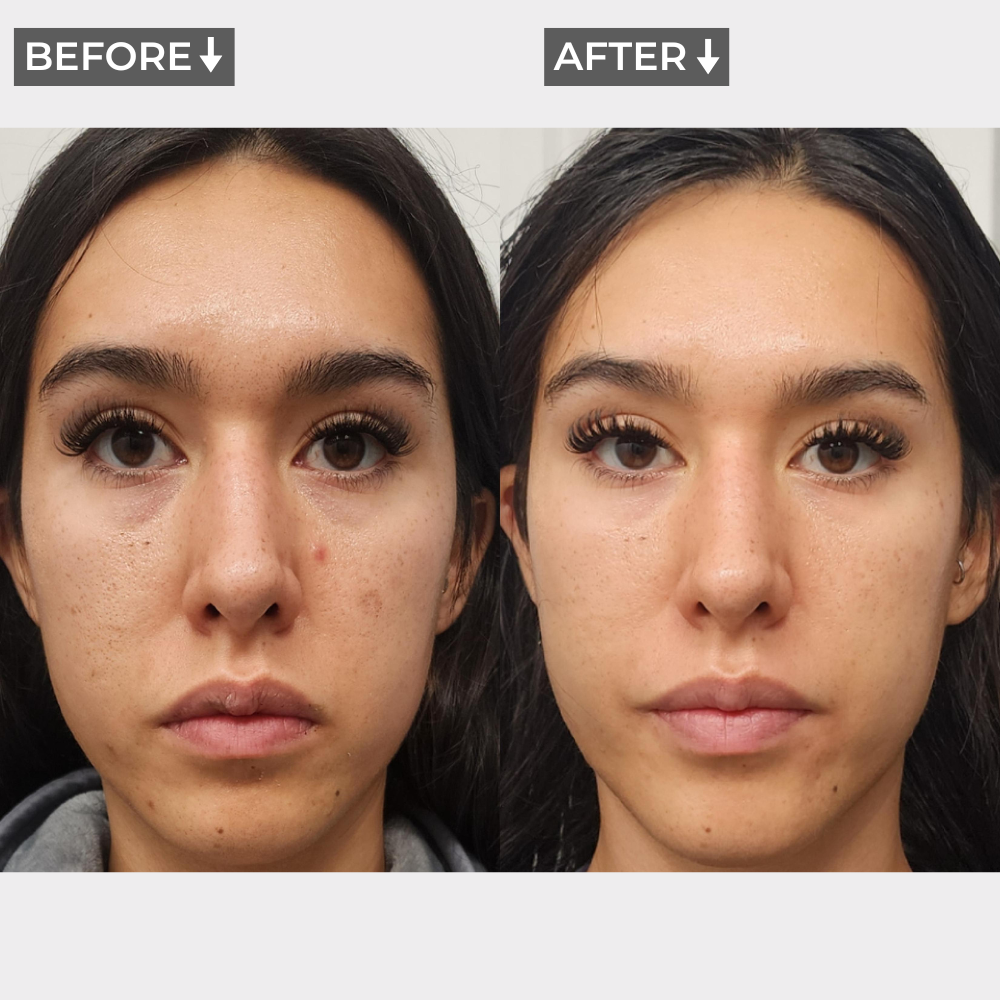 AURA+ Nuvibody® LED-Maske + Dekolleté-Set